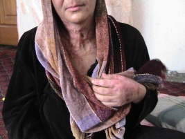 The good folk respond to a special appeal for help from a woman subjected to burns by donating contributions and yet there is still an urgent need for more donations.